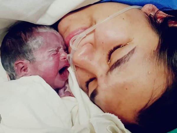 Nació IRIS, la bebita  operada dentro de  la panza de su mamá