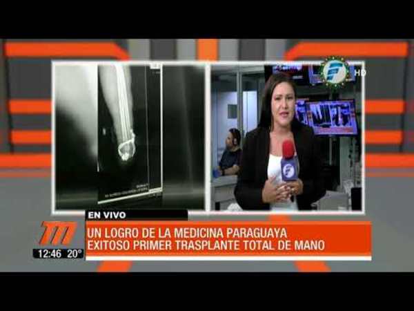 Exitoso primer trasplante total de mano en Paraguay