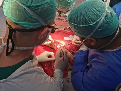 Médicos del IPS reimplantaron una mano amputada por una guillotina