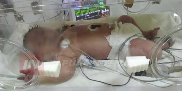MSP y BS sin respuesta a bebé que requiere de urgencia terapia intensiva - Digital Misiones