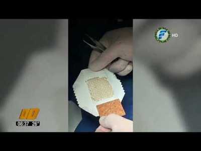 Primer implante de piel con técnica innovadora