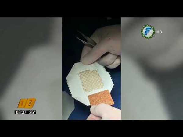 Primer implante de piel con técnica innovadora