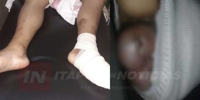 URGE CIRUGÍA DE AMPUTACIÓN PARA MUJER EN HRE.