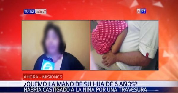 Imputan a madre por quemar la mano de su hija