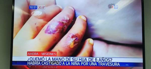 Horror en San Ignacio, quemó la mano de su propia hija - Digital Misiones