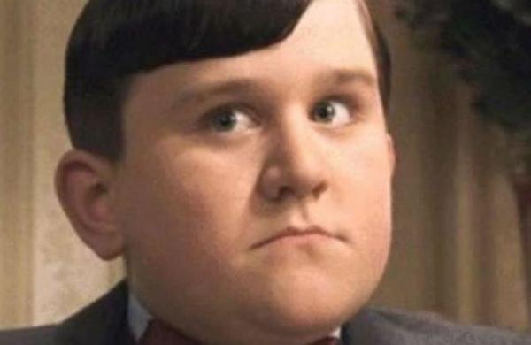 La increíble metamorfosis de Dudley, el primo malo de Harry Potter - SNT