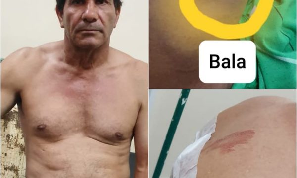 Joven balea a su vecino