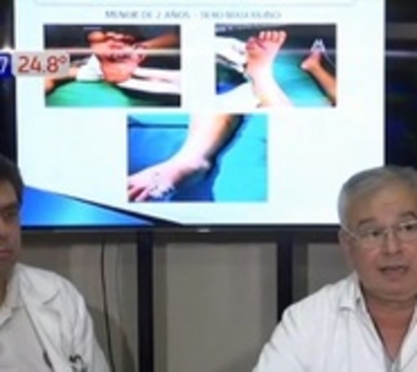 Año nuevo: Reporte oficial habla de dos niños afectados por pirotecnia - Paraguay.com