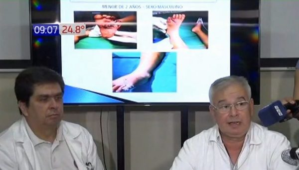 Niño de 2 años perderá dedo tras pisar cebollón | Noticias Paraguay
