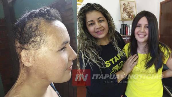 ENCARNACENA VIAJÓ A FRAM PARA ENTREGAR PELUCA A UNA NIÑA QUE PERDIÓ EL CABELLO TRAS UN INCENDIO.