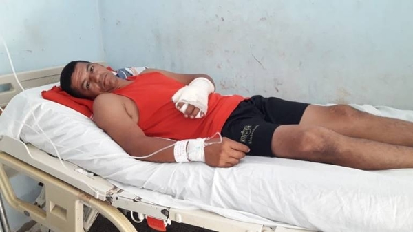 HOY / Cebollón tampoco es juego de adultos: "Yo quería tirar y explotó por mi mano"