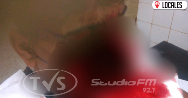 Confirman muerte del joven cuyo rostro quedó desfigurado