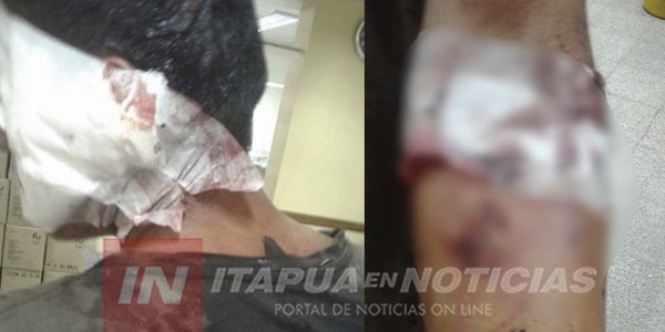 AMIGOS DE TRAGOS DISCUTIERON Y UNO FUE A PARAR AL HOSPITAL.