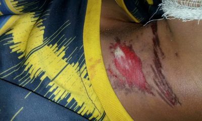 Menor fallece electrocutado
