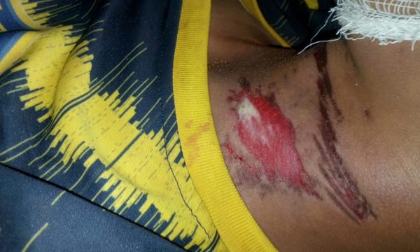 Menor fallece electrocutado