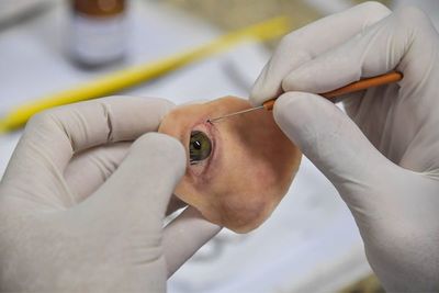 Prótesis de bajo costo le da una nueva cara a sobreviviente de cáncer en Brasil