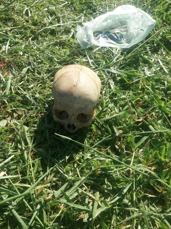 Hallaron cráneo durante limpieza en plaza de Lote Guazu | San Lorenzo Py