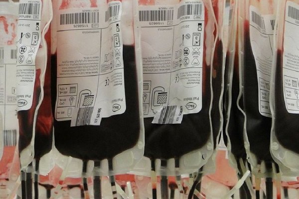 Falta de donantes de sangre afecta a las cirugías programadas