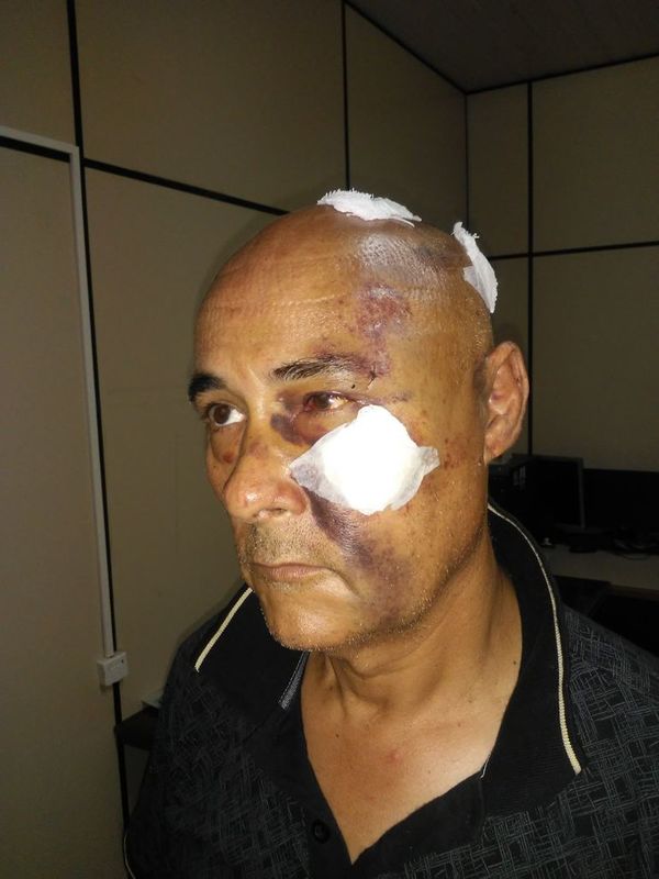 Español atacado en Encarnación exige investigación - Nacionales - ABC Color