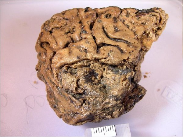 Cerebro de hombre decapitado se conservó más de 2.600 años