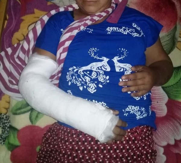 Mujer queda hospitalizada tras brutal agresión de su pareja en Caaguazú