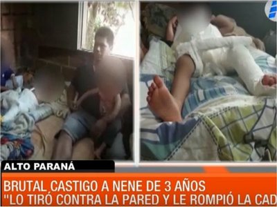 Pequeño sufre rotura de cadera por violencia intrafamiliar