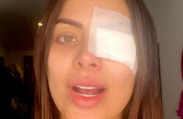 'Me destruí la córnea': actriz colombiana casi pierde un ojo por alargarse las pestañas - SNT