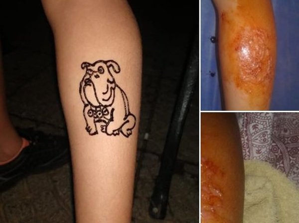 Madre alerta sobre tatuajes temporales en playas de Brasil | Noticias Paraguay
