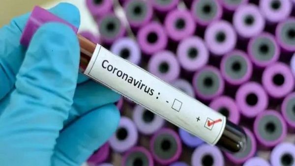 Paraguay emite alerta ante probable presencia de coronavirus en la región - .::RADIO NACIONAL::.