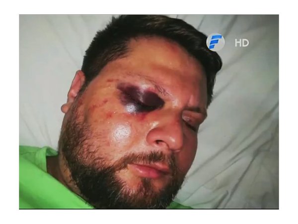 Turba de motociclistas casi mató a golpes a un conductor