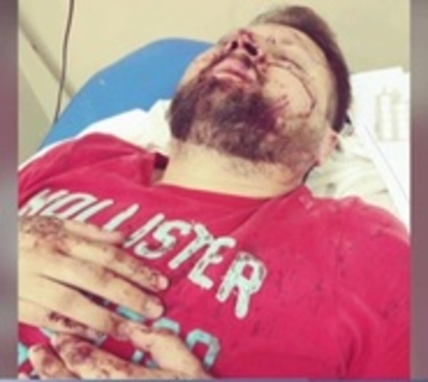 Atacan a hombre que intentó socorrer a víctima de accidente - Paraguay.com