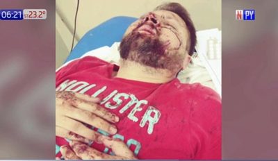 Turba de motociclistas ataca a conductor en San Antonio | Noticias Paraguay