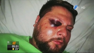Turba de motociclistas casi mató a golpes a un conductor [VÍDEO]