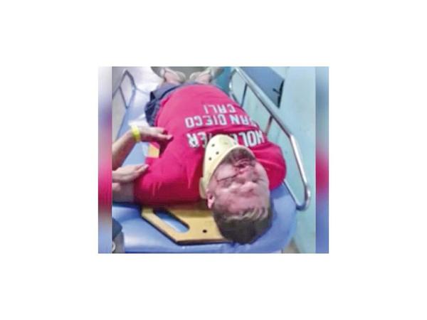 Un hombre recibió terrible golpiza de 40 motociclistas