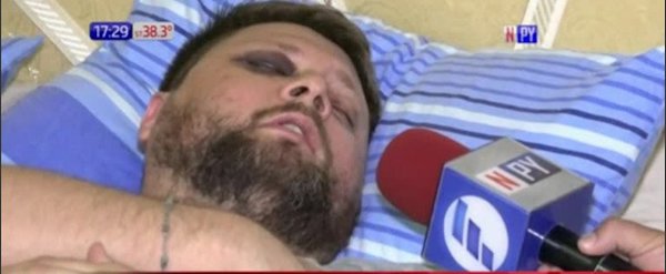 Habla víctima que fue ataco por una turba de motociclistas | Noticias Paraguay