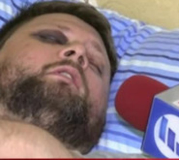 Habla víctima que fue atacado por una turba de motociclistas - Paraguay.com