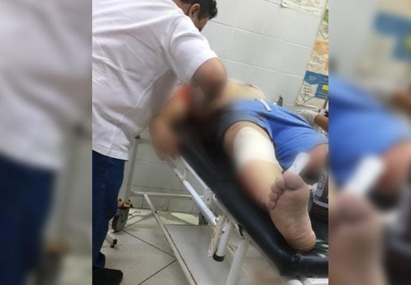 Tras partido de fútbol, se desató balacera con un muerto y heridos en Capitán Bado - Nacionales - ABC Color