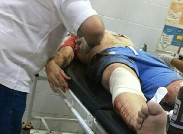 Hay cuatro heridos tras atentado en Capitán Bado que acabó con dos vidas
