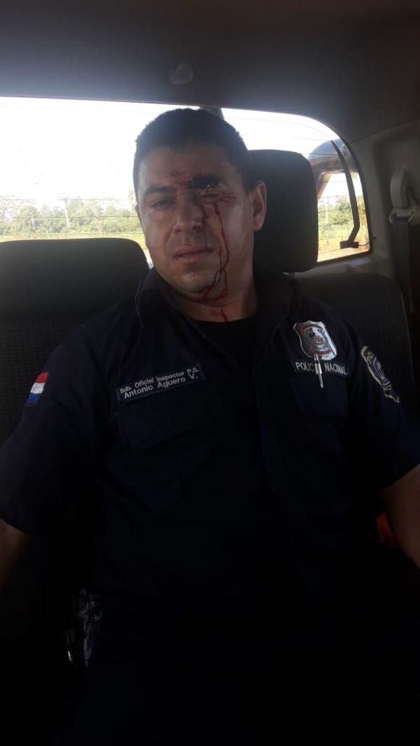 Enfrentamiento entre policías y labriegos en Repatriación - Nacionales - ABC Color