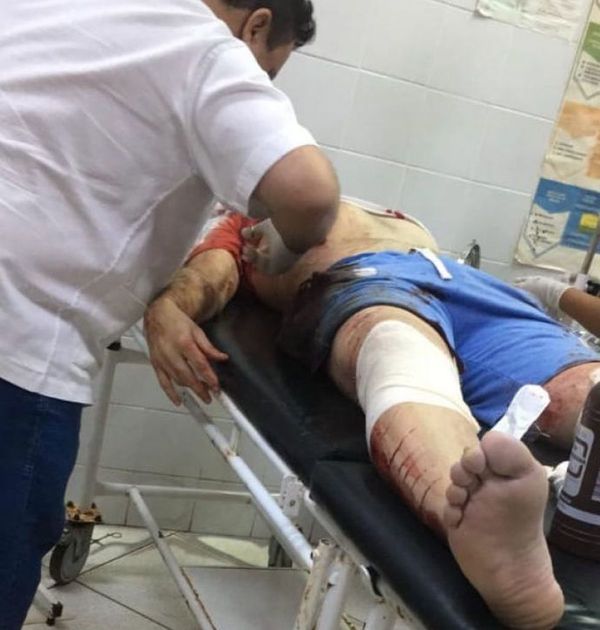 Dos fallecidos y un futbolista herido durante atentado en Capitán Bado