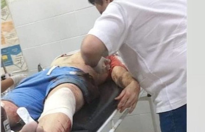 Demencial ataque a tiros en Capitán Bado