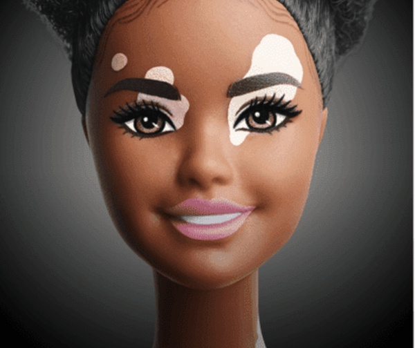 Barbie incluye la muñeca con vitiligo en su nueva colección