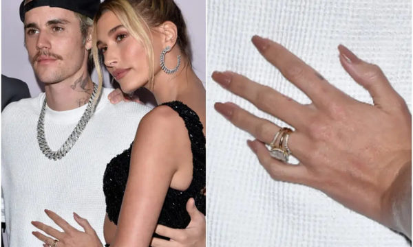 Hailey Baldwin pide a sus fans que dejen de burlarse de sus manos