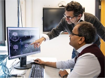 Científicos descubren rata que vivió prácticamente sin cerebro