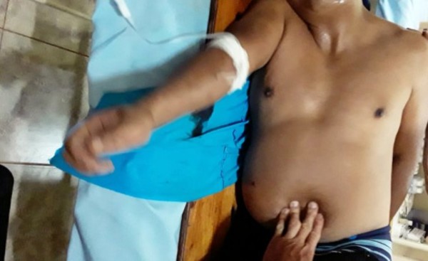 Muere tras recibir un disparo en el abdomen