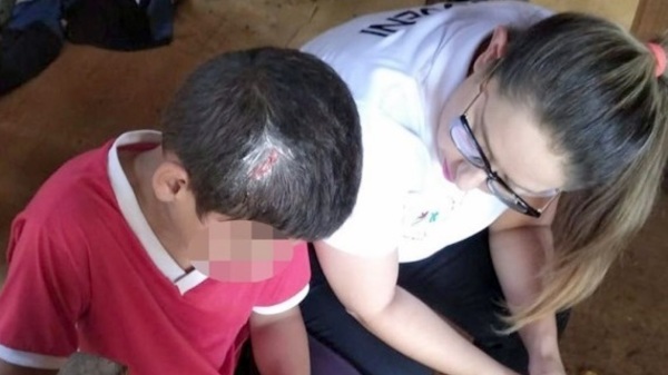 Un menor de 11 años fue atacado a guampazos