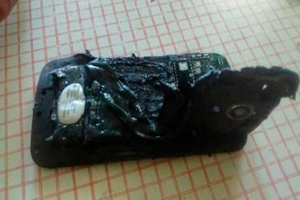 Joven argentino con quemaduras graves tras explotar su teléfono mientras dormía » Ñanduti
