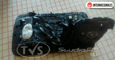 Joven argentino con quemaduras graves tras explotar su teléfono mientras dormía
