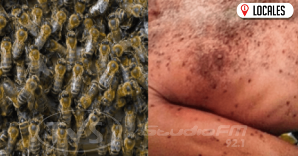 Hombre fue atacado por un enjambre de abejas y falleció