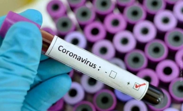 HOY / Coronavirus: se aguarda resultados de muestra remitida a USA de un caso sospechoso